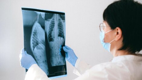 Ingyenes tüdőrákszűrés szombaton a Korányiban