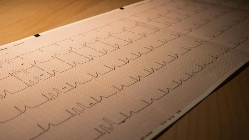 img_Megterhelo_lehet_az_unnep__figyeljunk_magunkra_